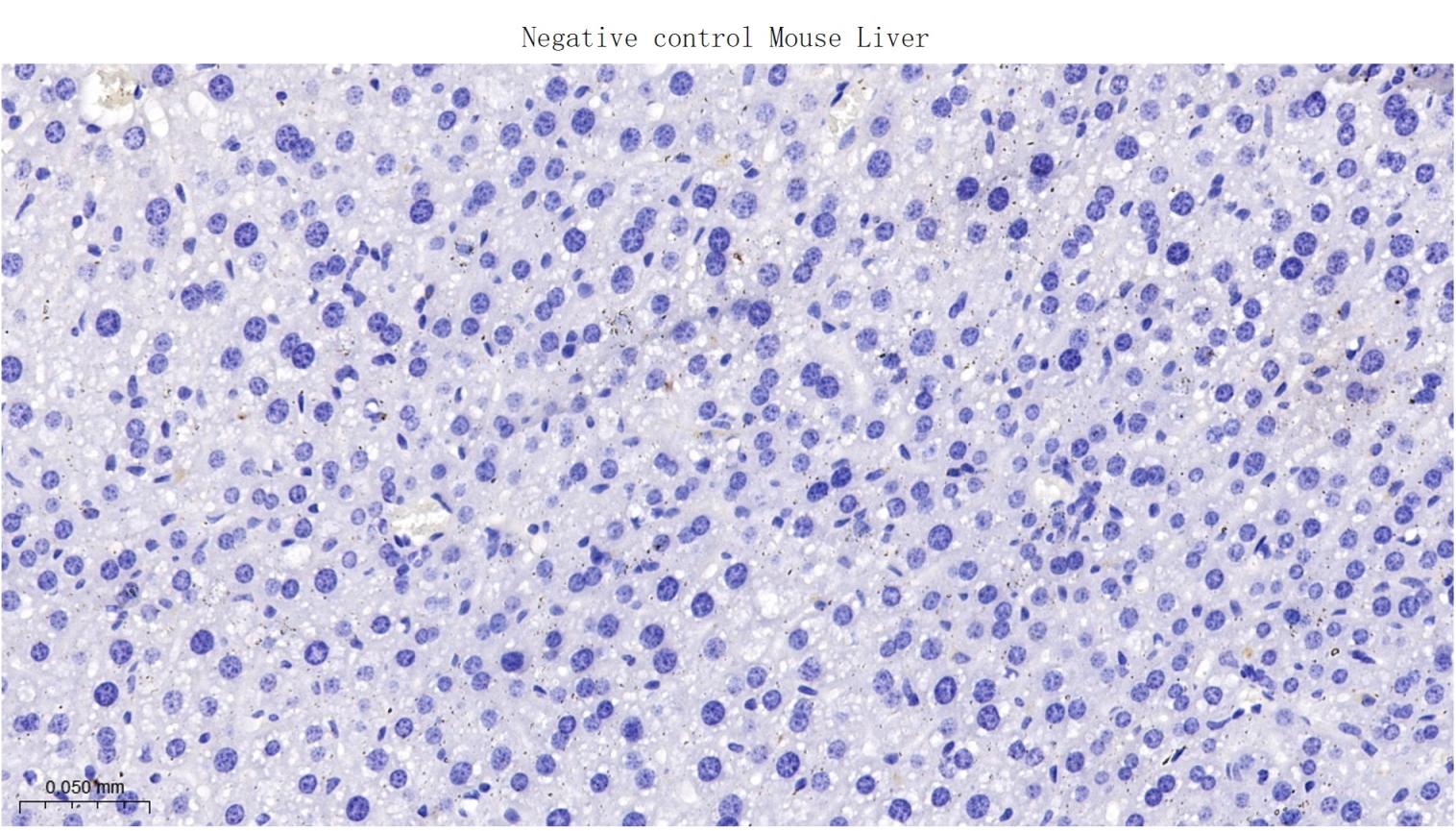 Rabbit anti-RAGE Monoclonal Antibody