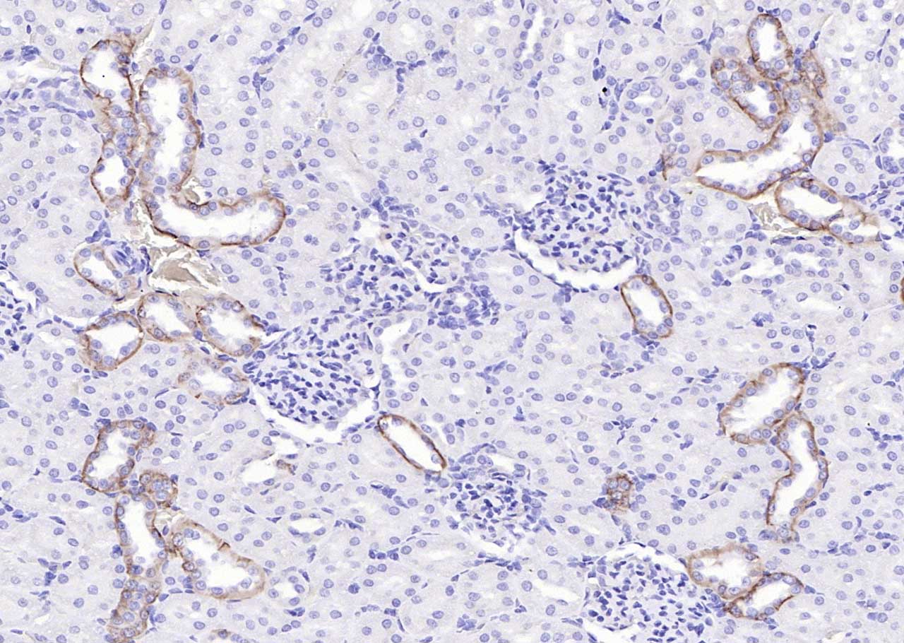 Rabbit anti-EGFR Polyclonal Antibody