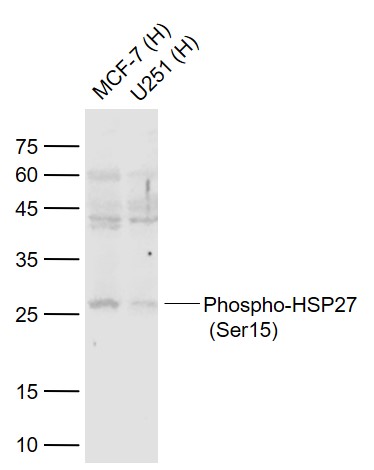 Rabbit anti-Phospho-HSP27(Ser15) Polyclonal Antibody