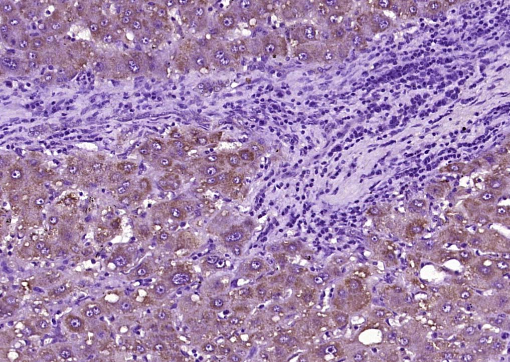 Rabbit anti-SOD2 Polyclonal Antibody