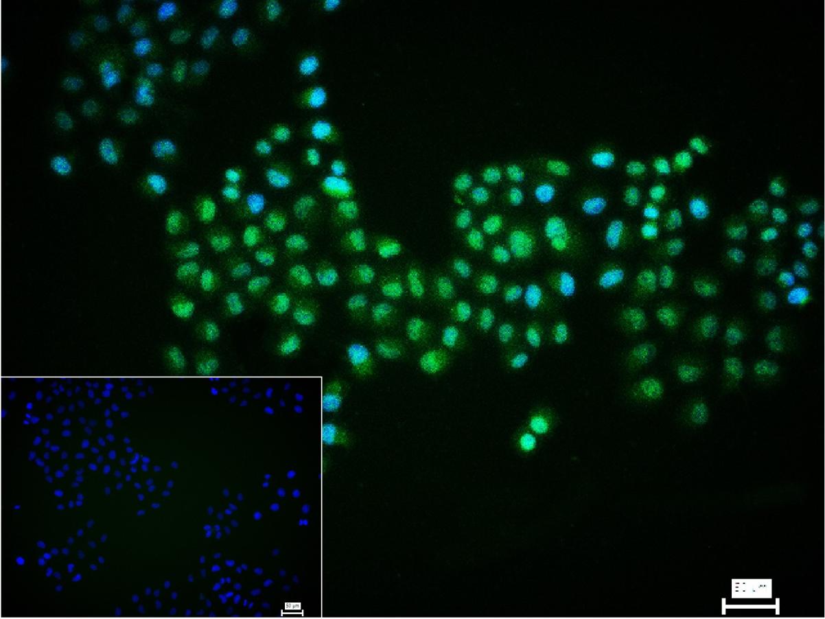 Rabbit anti-Phospho-AKT1(Ser129) Polyclonal Antibody