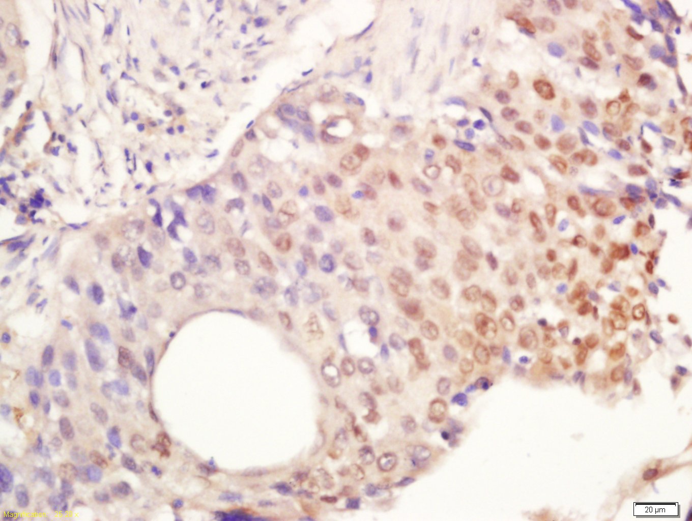 Rabbit anti-Phospho-IRAK1(Thr209) Polyclonal Antibody