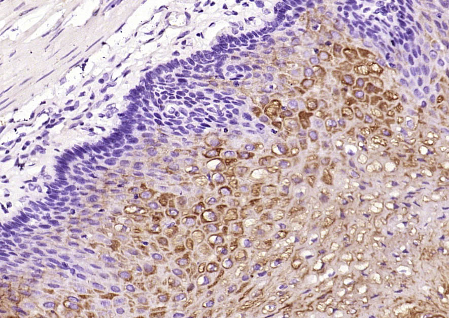 Rabbit anti-Cytokeratin 2e Monoclonal Antibody