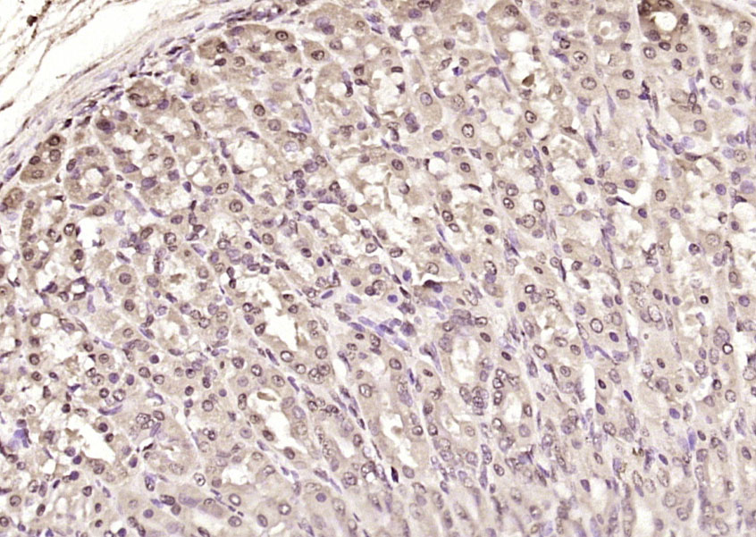 Rabbit anti-Phospho-IKBα(Tyr305) Polyclonal Antibody