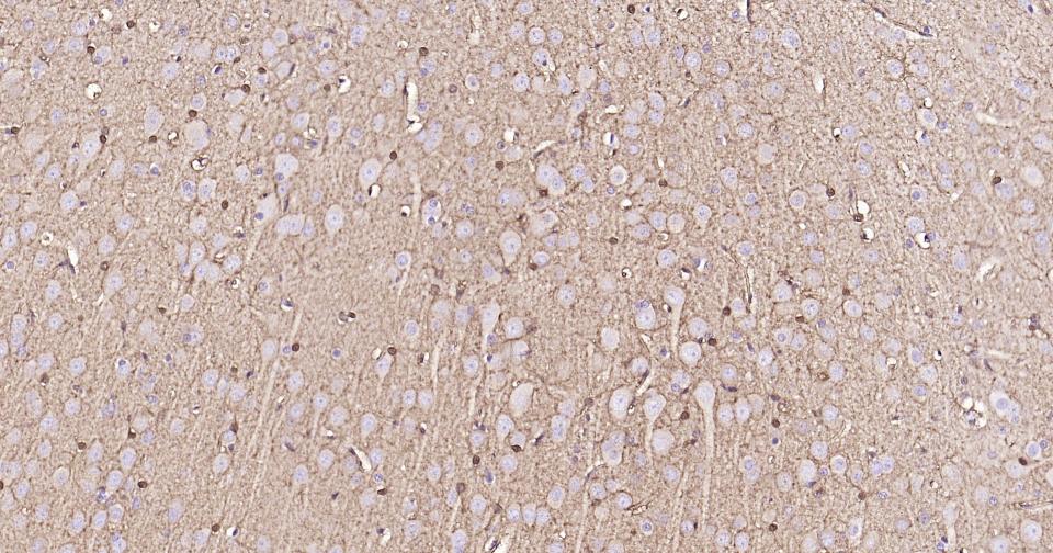 Mouse anti-S100B Monoclonal Antibody