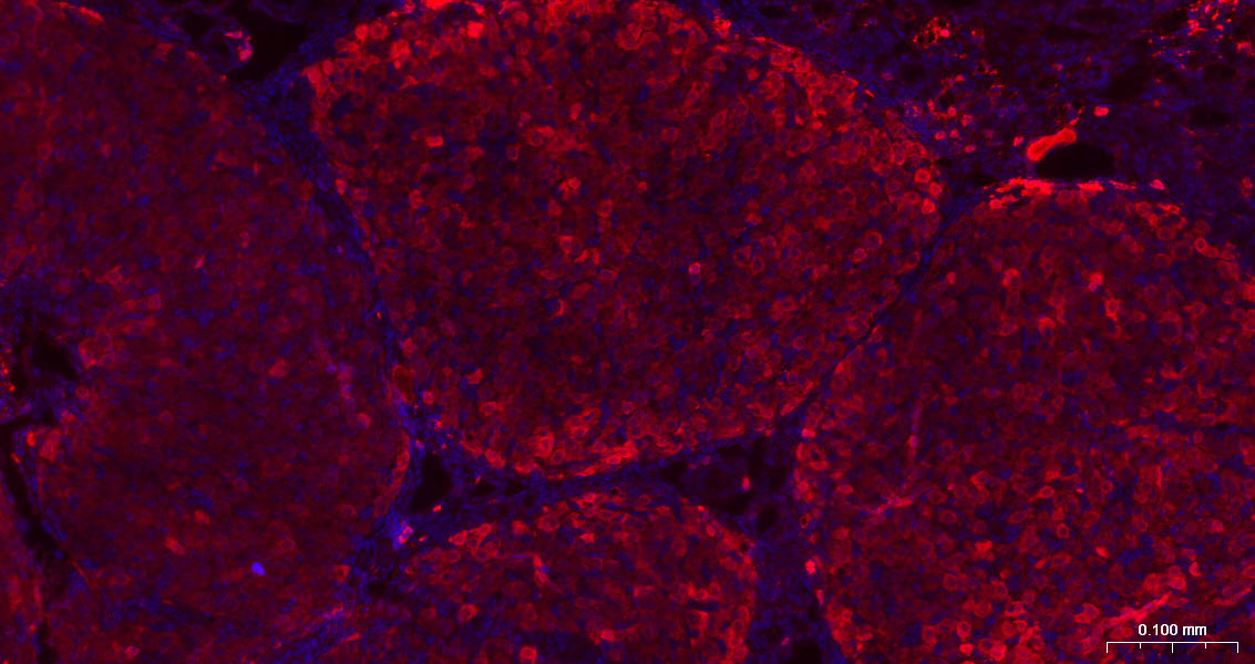 Rabbit anti-Galectin 3 Polyclonal Antibody