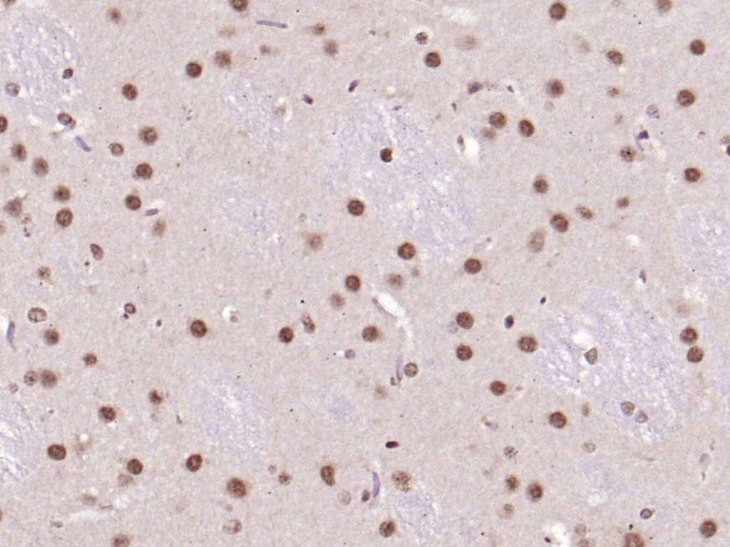 Rabbit anti-UBF1 Polyclonal Antibody