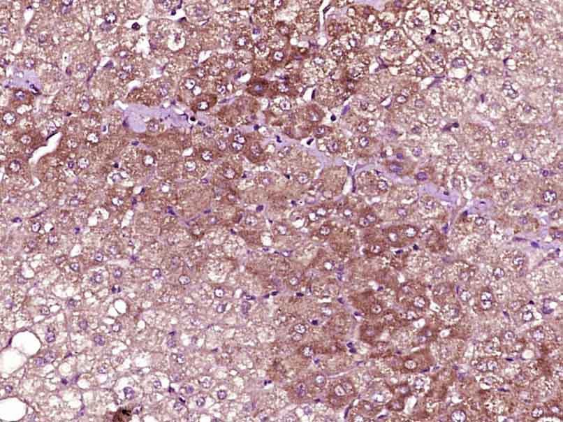 Rabbit anti-VEGF-C Polyclonal Antibody