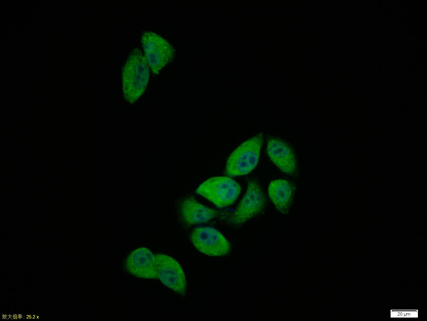Rabbit anti-Phospho-Smad3(Ser423) Polyclonal Antibody