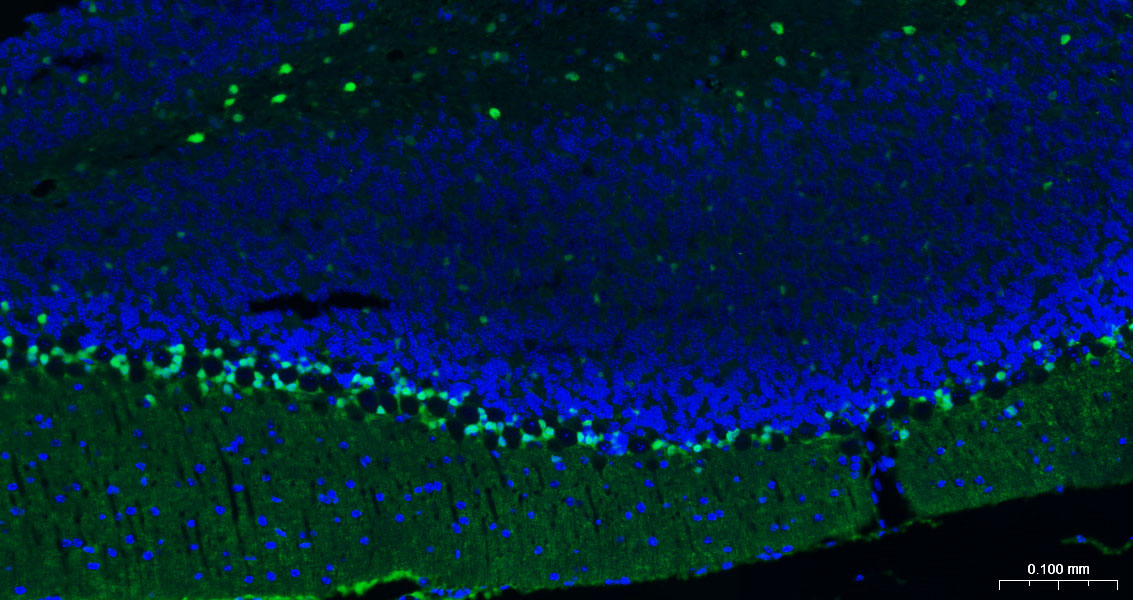 Mouse anti-S100B Monoclonal Antibody