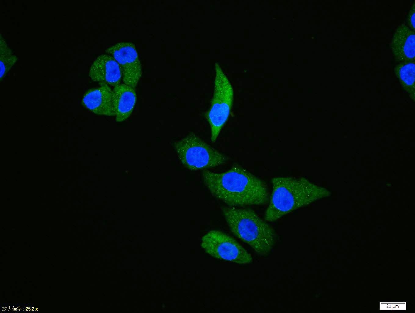 Rabbit anti-Phospho-TAK1(Ser192) Polyclonal Antibody