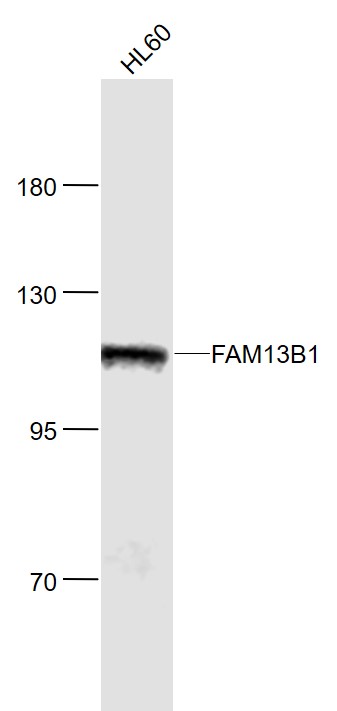 Rabbit Anti-FAM13B1 Polyclonal Antibody