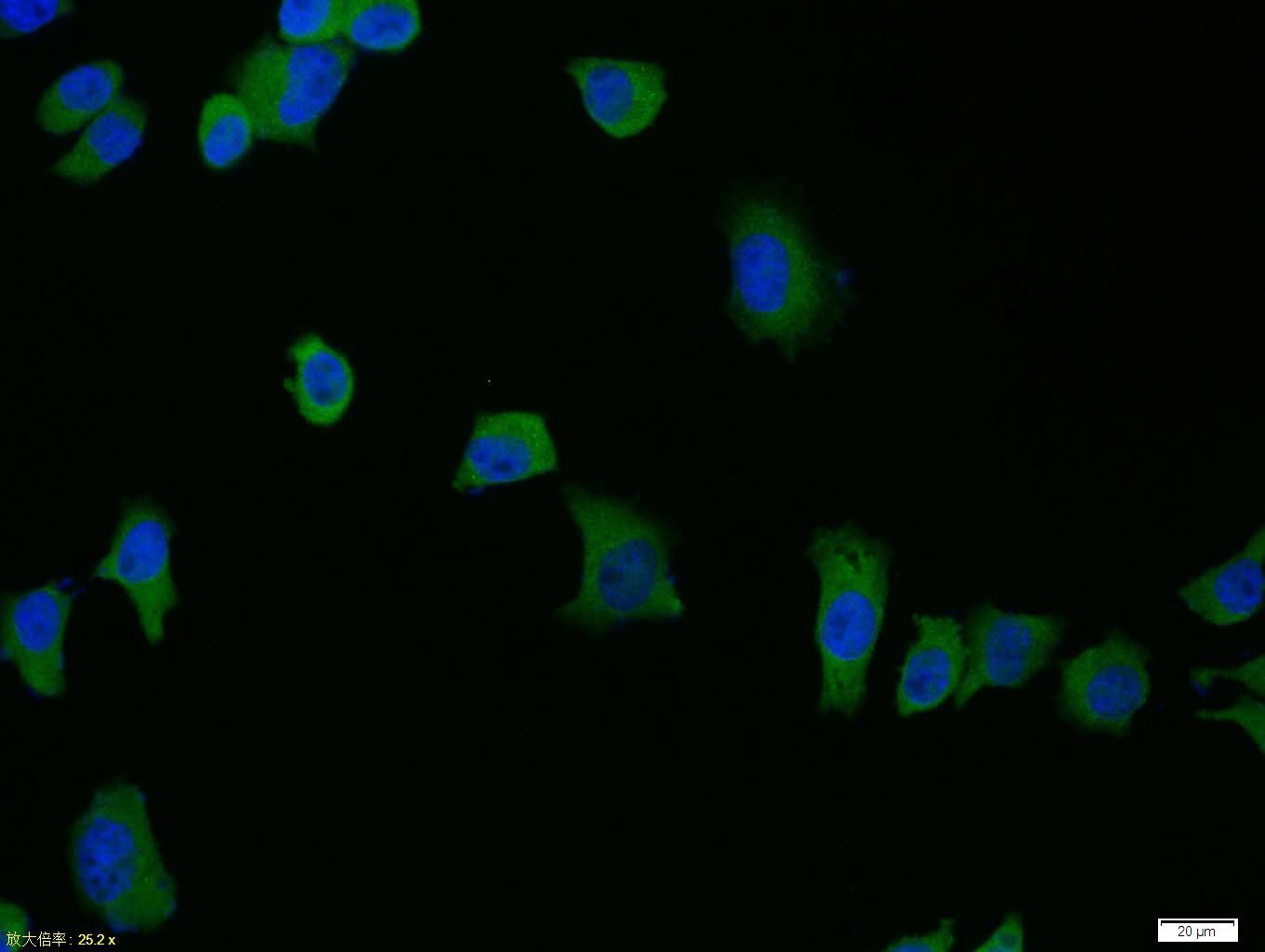 Rabbit anti-Phospho-IRAK1(Thr209) Polyclonal Antibody
