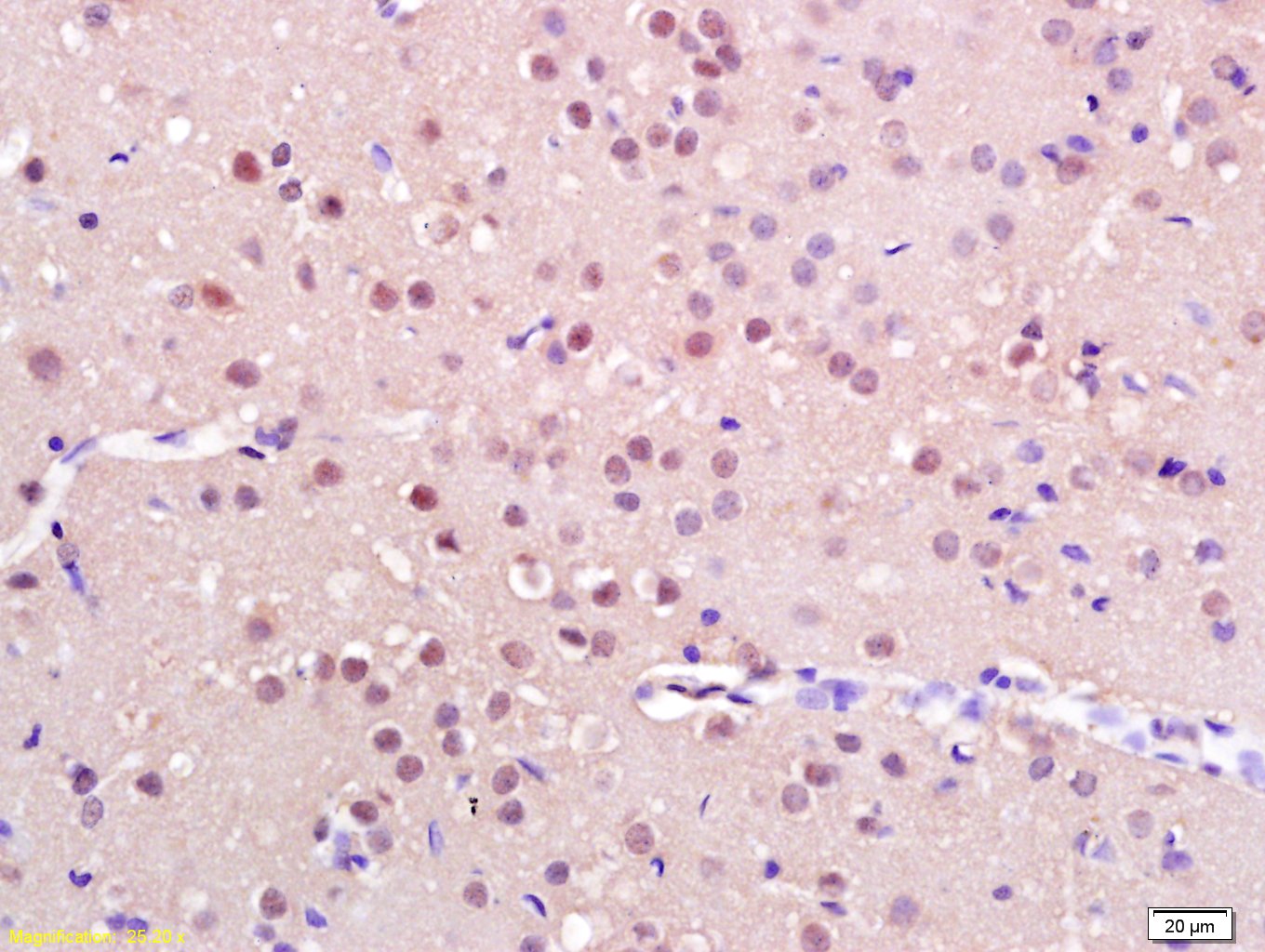 Rabbit anti-Iroquois Homeobox Protein 3 Polyclonal Antibody