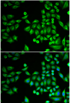 Rabbit anti-PTPN1 Polyclonal Antibody