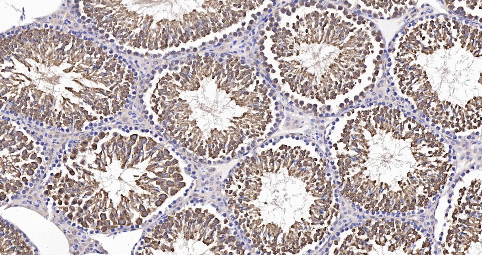 Rabbit anti-HSP70 Monoclonal Antibody
