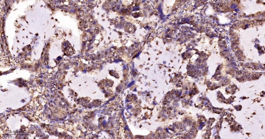 Rabbit anti-LDHA Polyclonal Antibody