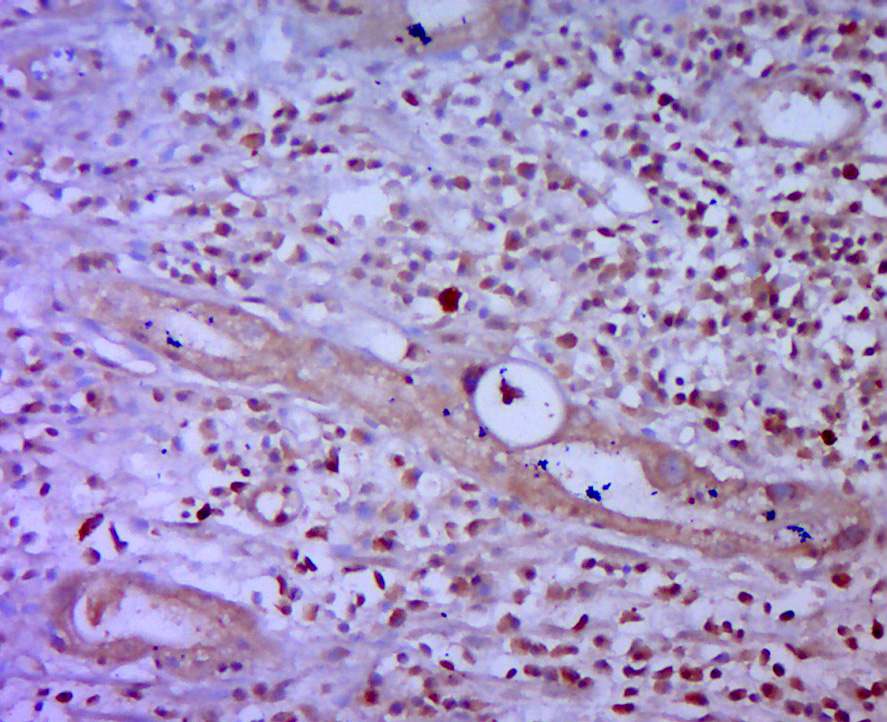 Rabbit anti-Phospho-HSP27(Ser15) Polyclonal Antibody