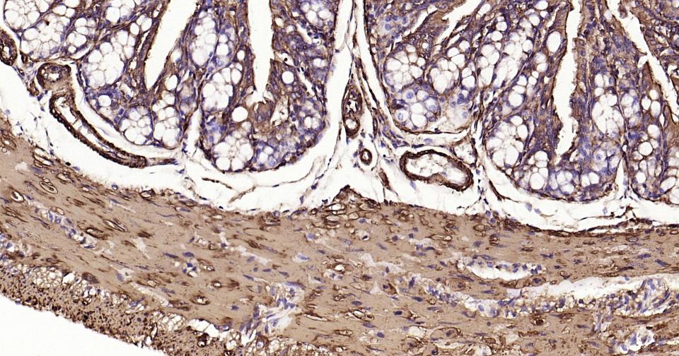 Rabbit anti-α Smooth Muscle Actin Monoclonal Antibody
