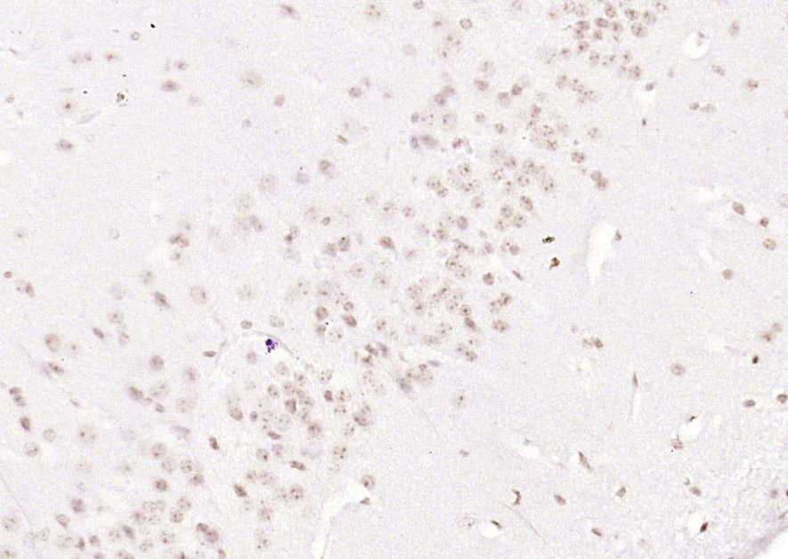 Rabbit Anti-LRRC41 Polyclonal Antibody