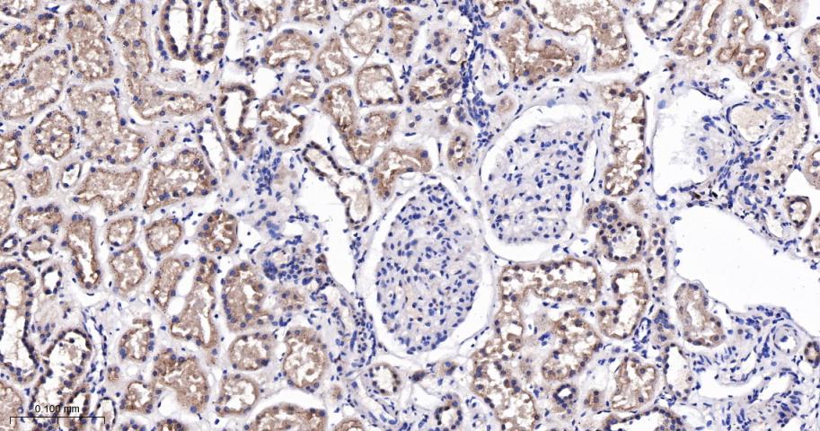 Rabbit anti-TSG101 Monoclonal Antibody