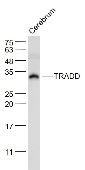 Rabbit Anti-TRADD Polyclonal Antibody