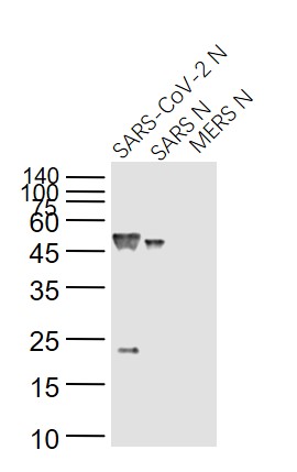 Mouse anti-SARS-CoV Nucleocapsid Monoclonal Antibody