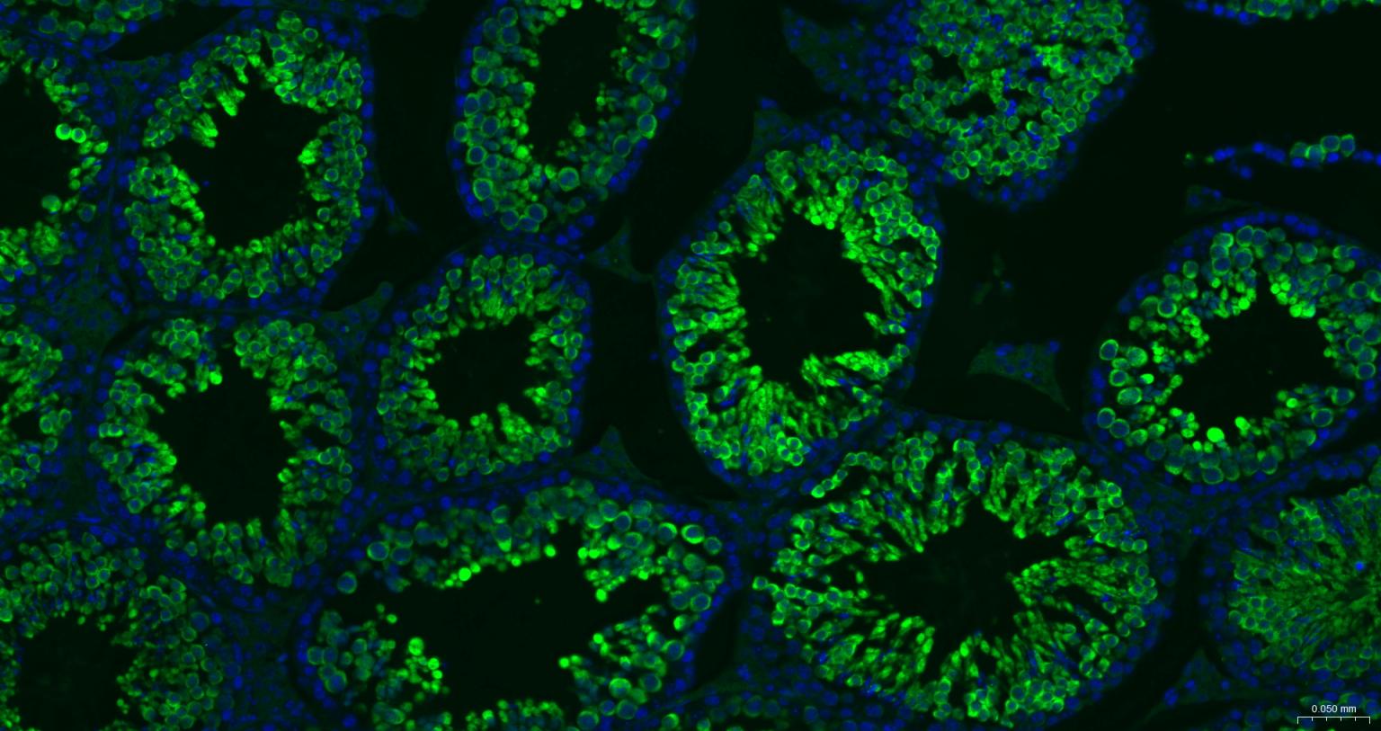 Rabbit anti-HSP70 Monoclonal Antibody