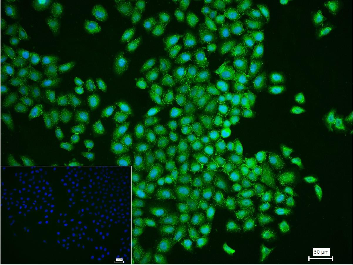 Rabbit anti-Phospho-EGFR(Ser1142) Polyclonal Antibody