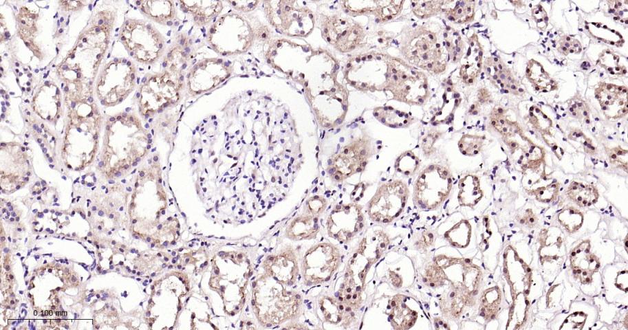 Rabbit anti-NADPH Oxidase 4 Monoclonal Antibody