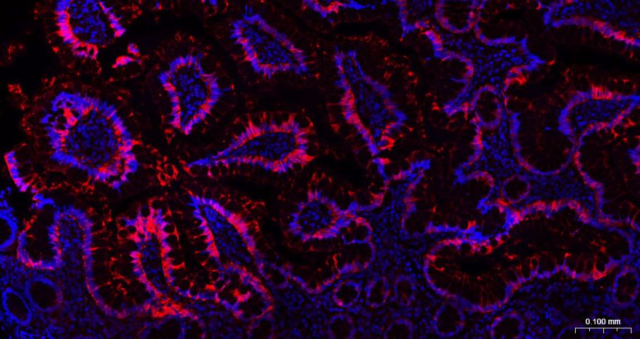 Rabbit anti-Galectin 3 Polyclonal Antibody