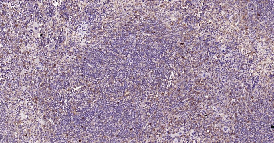 Rabbit anti-Galectin 3 Polyclonal Antibody