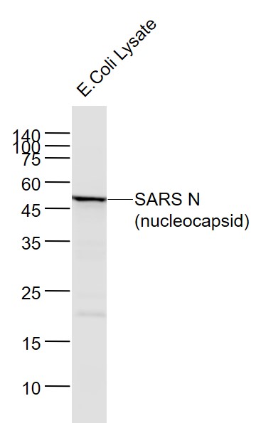 Mouse anti-SARS-CoV Nucleocapsid Monoclonal Antibody