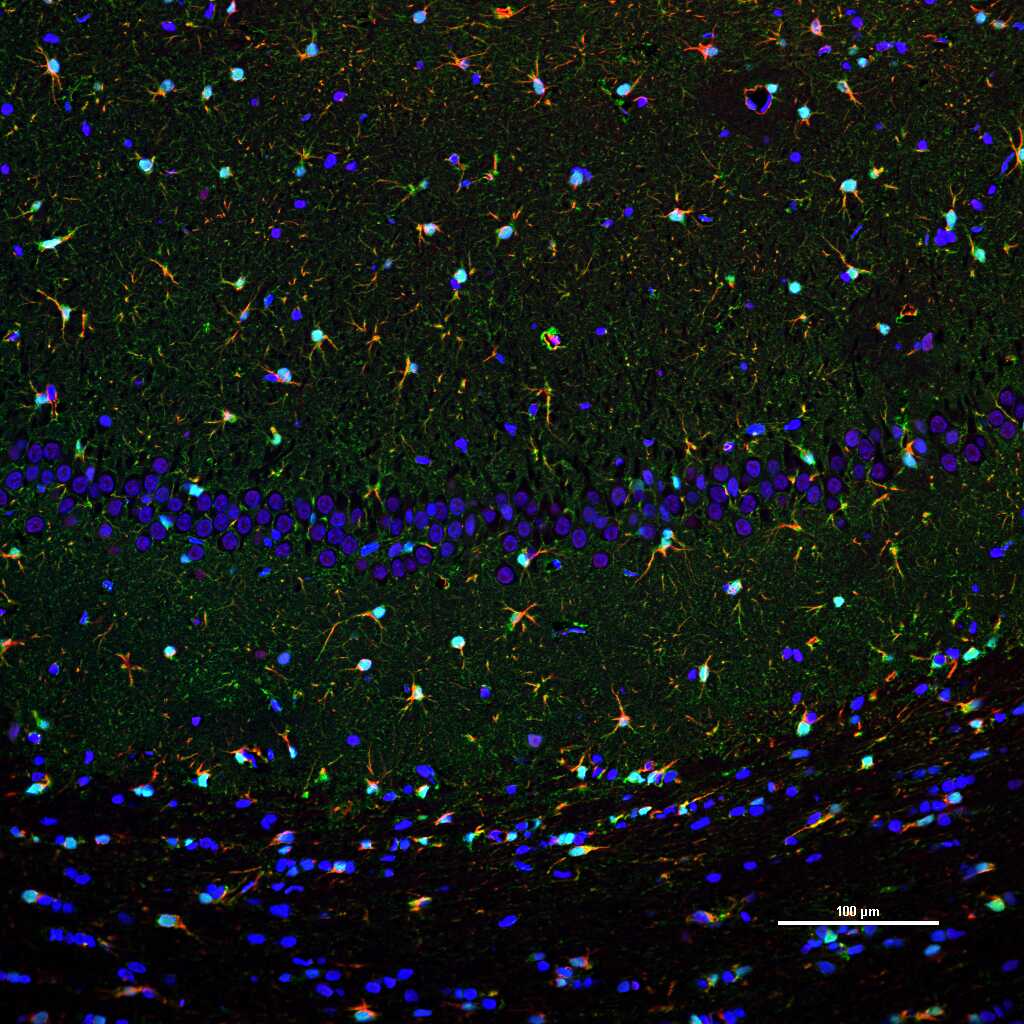 Mouse anti-S100B Monoclonal Antibody