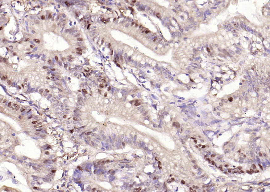 Rabbit anti-Phospho-β-Catenin(Ser33+Ser37) Polyclonal Antibody