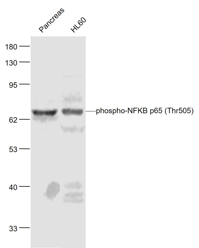Rabbit anti-Phospho-NFKB p65(Thr505) Polyclonal Antibody