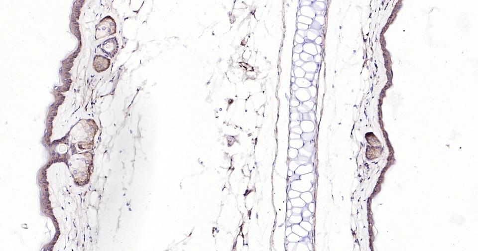 Rabbit anti-Bax Monoclonal Antibody