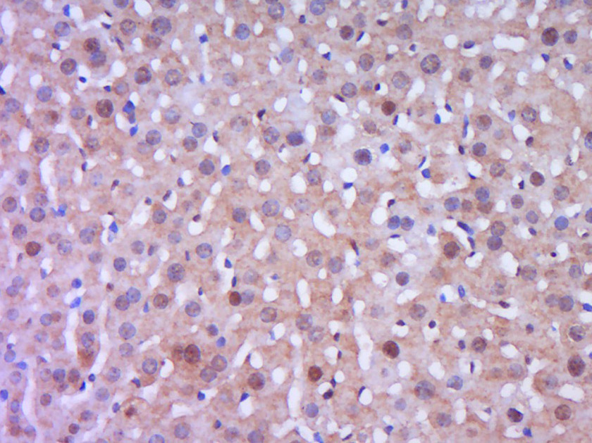 Rabbit anti-Phospho-IKBα(Tyr305) Polyclonal Antibody