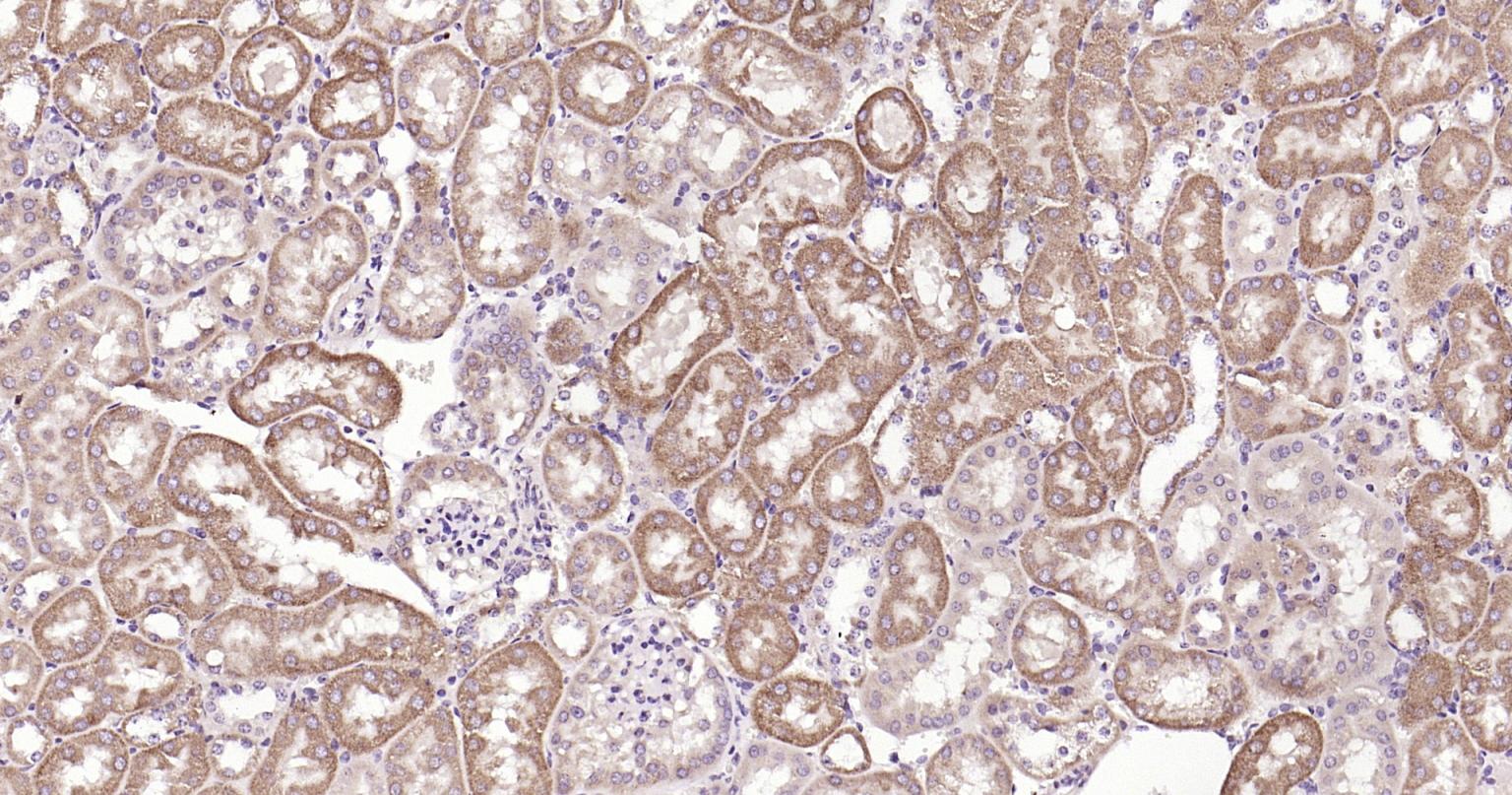 Rabbit anti-Beclin 1 Polyclonal Antibody