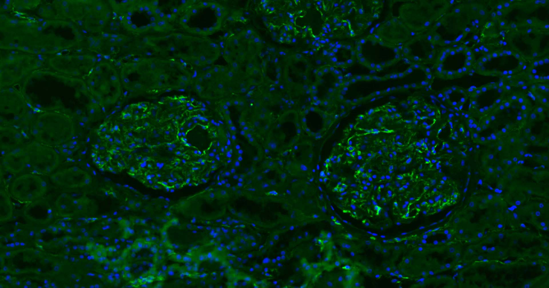 Mouse anti-CD31 Monoclonal Antibody