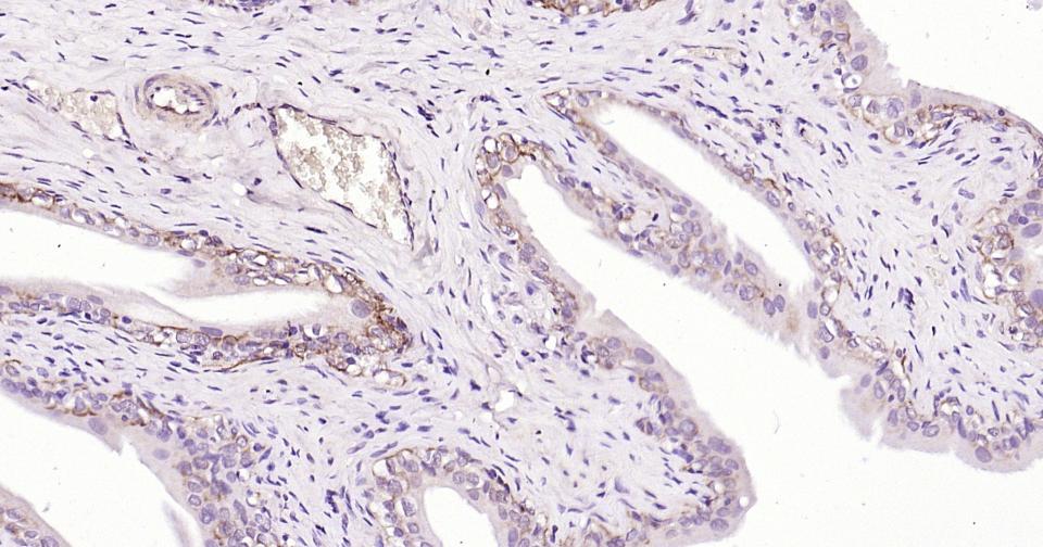 Mouse anti-Cytokeratin 19 Monoclonal Antibody