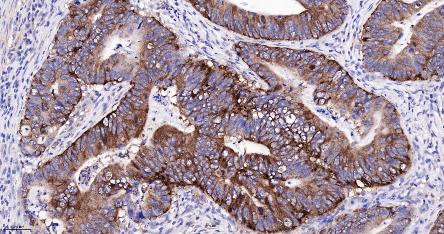 Rabbit anti-NFKB p65 Monoclonal Antibody