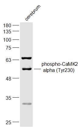 Rabbit anti-Phospho-CaMK2α(Tyr230) Polyclonal Antibody