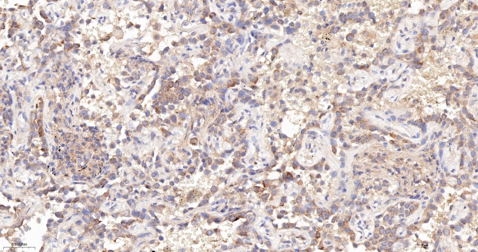 Rat anti-PTEN Monoclonal Antibody
