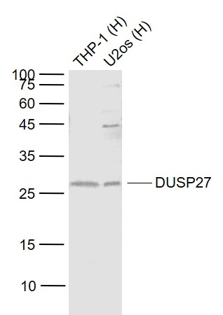 Rabbit anti-DUSP27 Polyclonal Antibody
