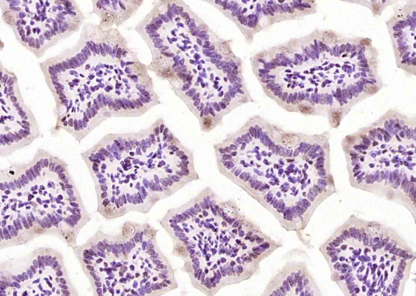 Rabbit Anti-PP1A/PP2CA/PPP1CA Polyclonal Antibody