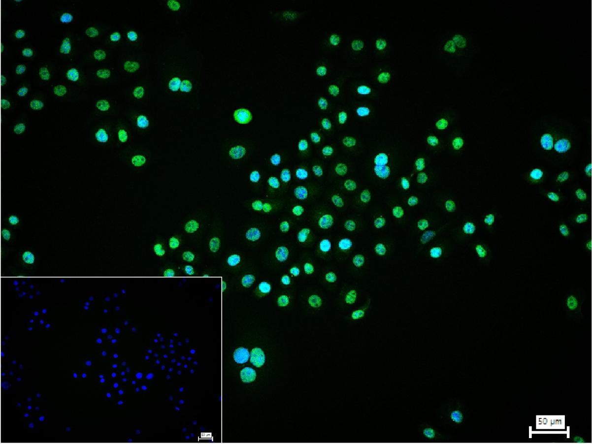 Rabbit anti-TSG101 Monoclonal Antibody