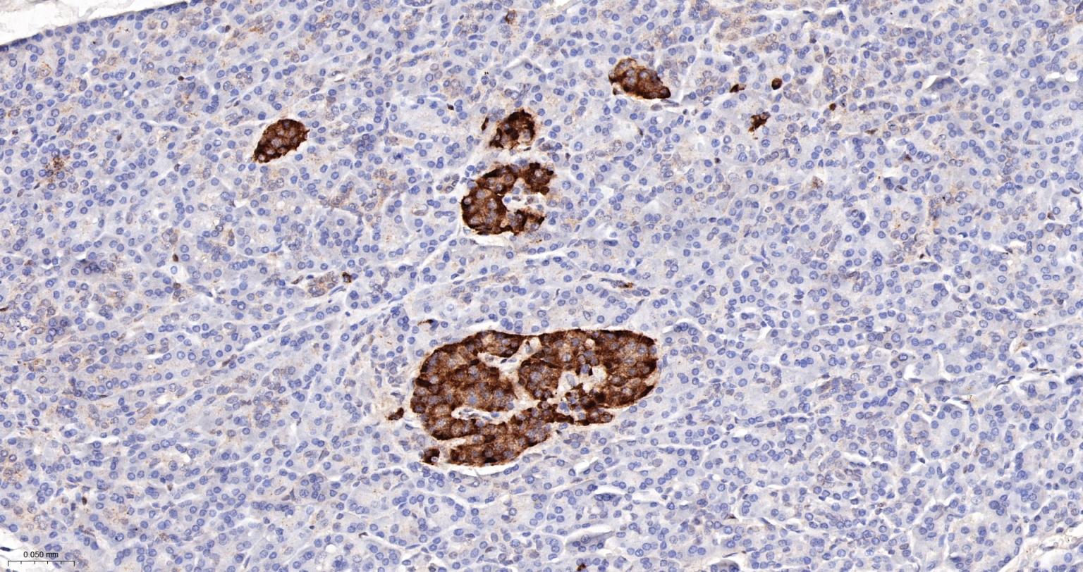 Rat anti-PTEN Monoclonal Antibody