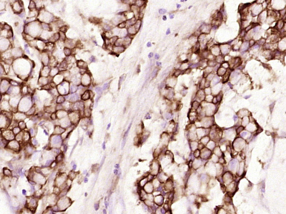 Mouse anti-Cytokeratin 19 Monoclonal Antibody
