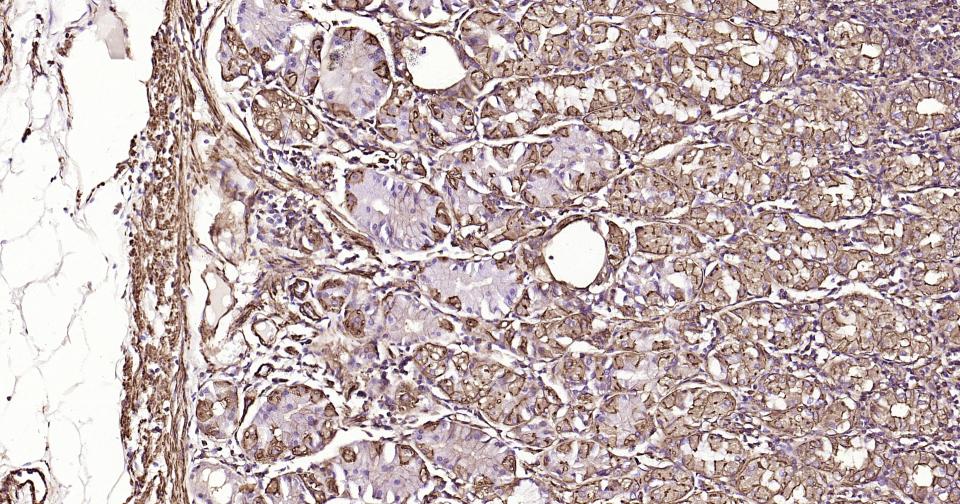 Rabbit anti-α Smooth Muscle Actin Monoclonal Antibody
